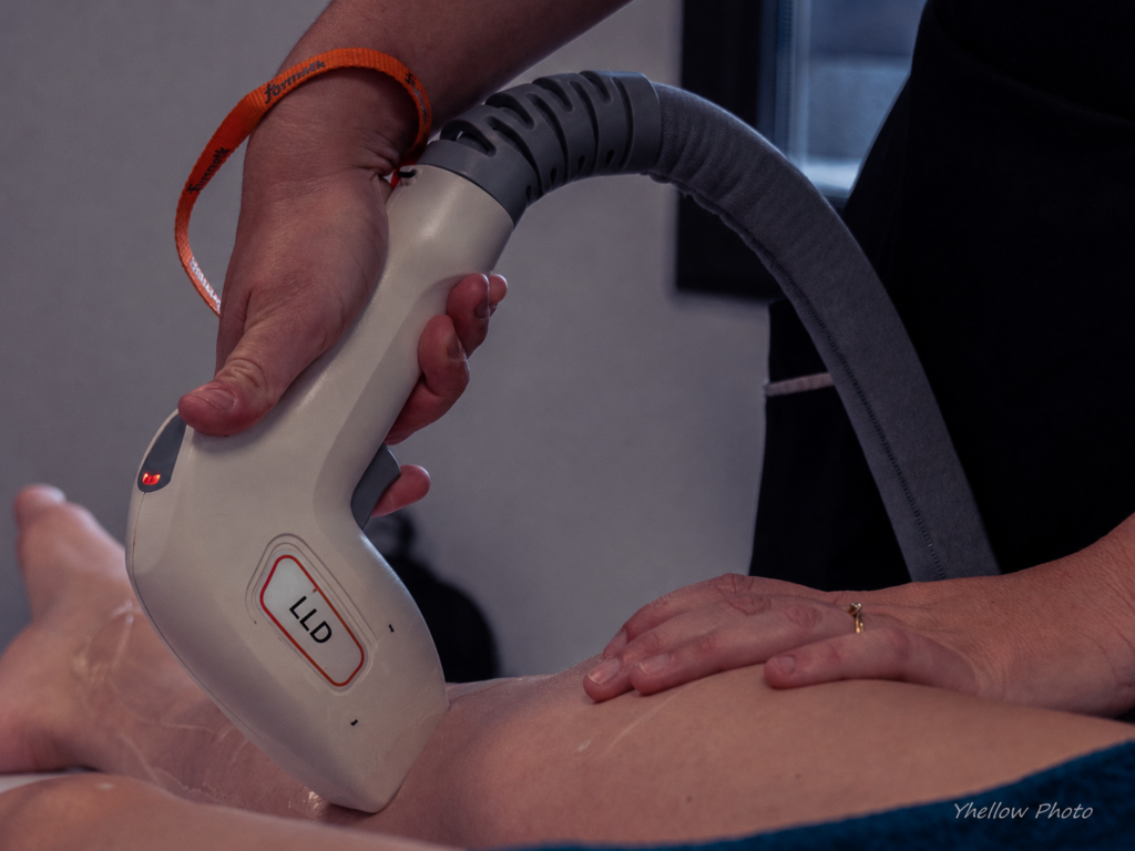 Épilation laser à Saint-Maximin : pourquoi elle est réalisée sous supervision médicale chez MTech