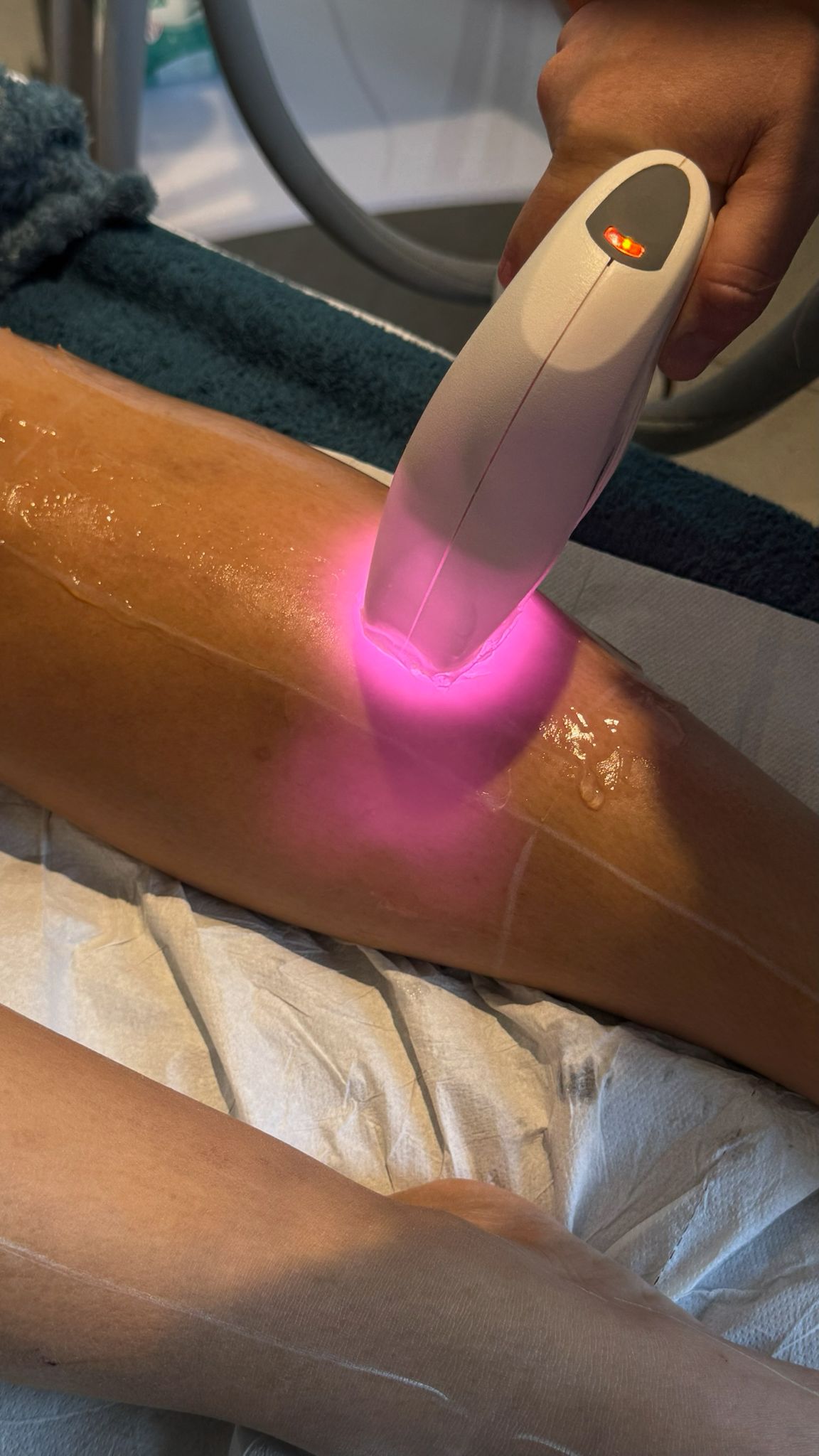 Accueil Épilation laser définitive MTech Saint-Maximin — Laser et Thermolyse